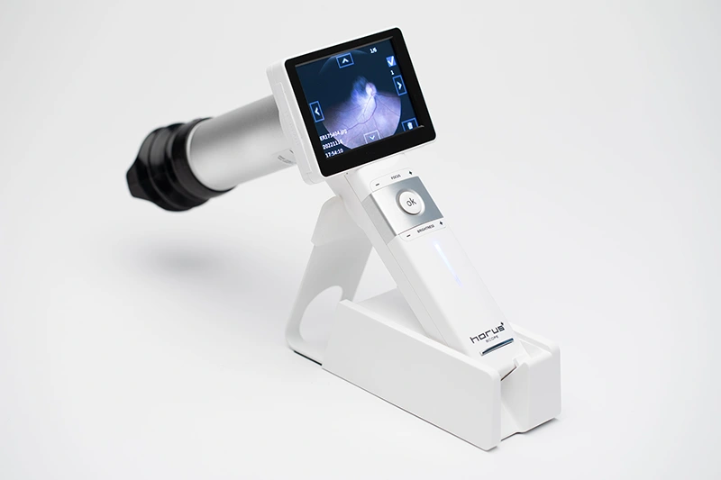 DEC 200 Digital Ophthalmoscope Camera System